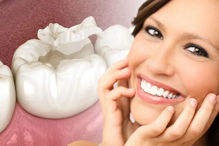 Dental-Sealants-Extra-Protection-for-Your-Smile