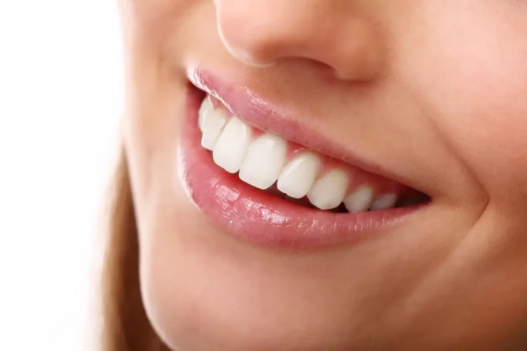 Teeth-Whitening-Brighten-Your-Smile-Today