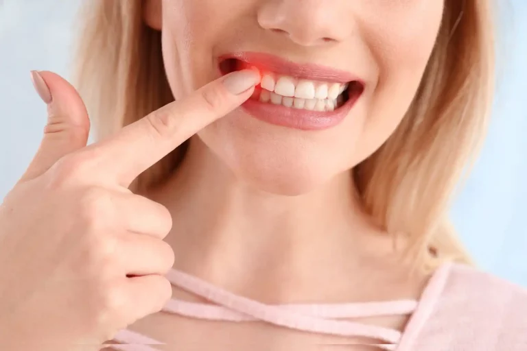 Understanding-Gum-Disease-and-Its-Prevention