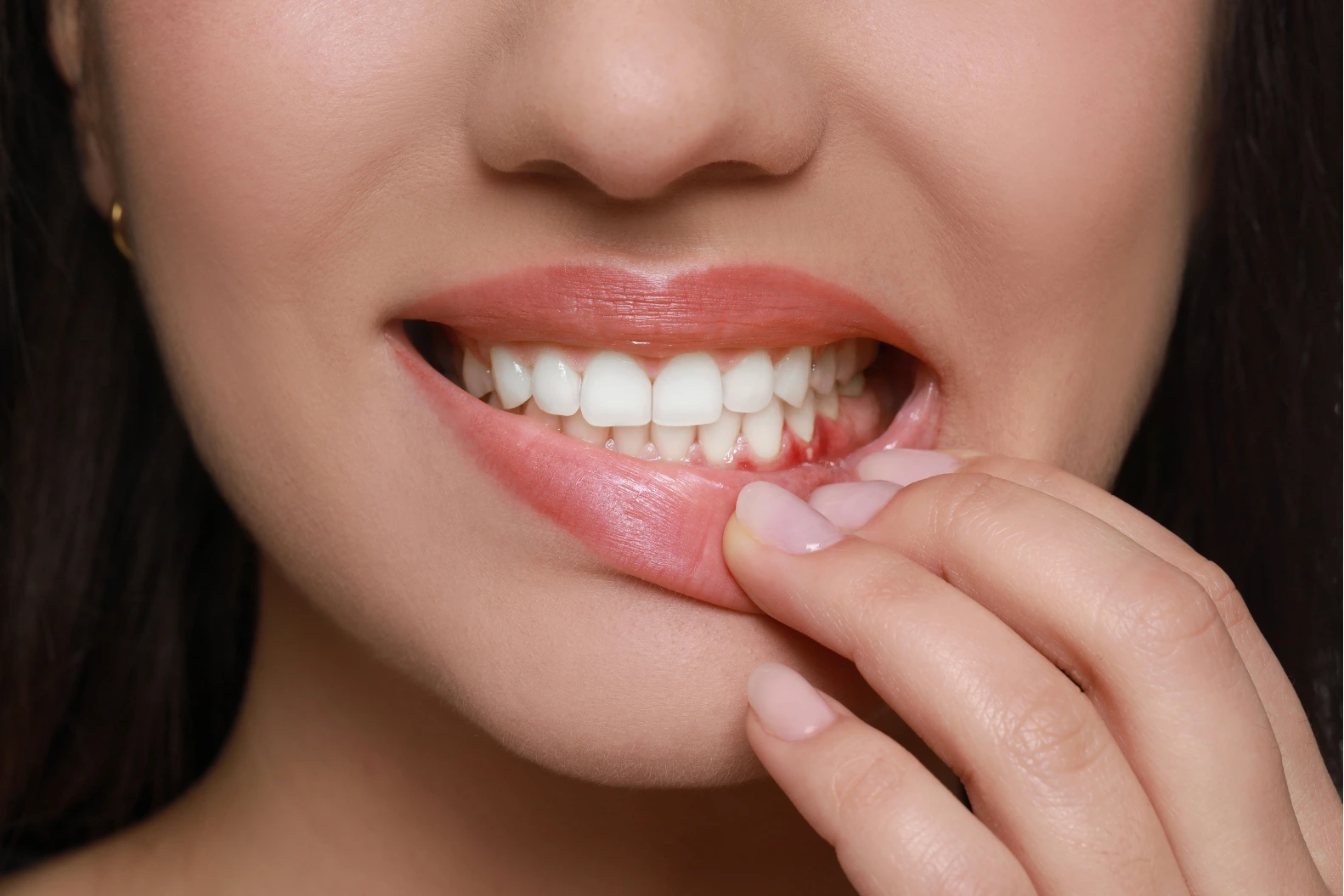Gum-Disease-Awareness-Protect-Your-Smile-This-Winter