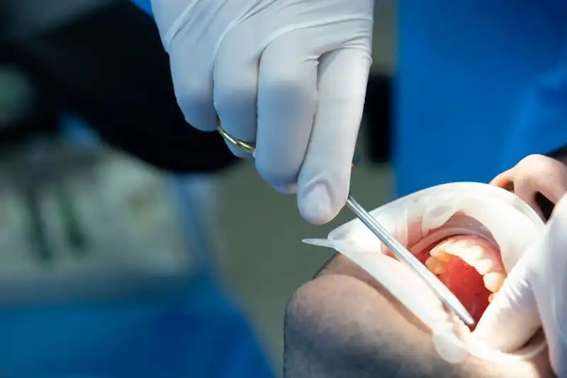 Oral-Surgery-1