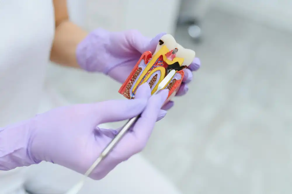 Root-Canal-Treatment