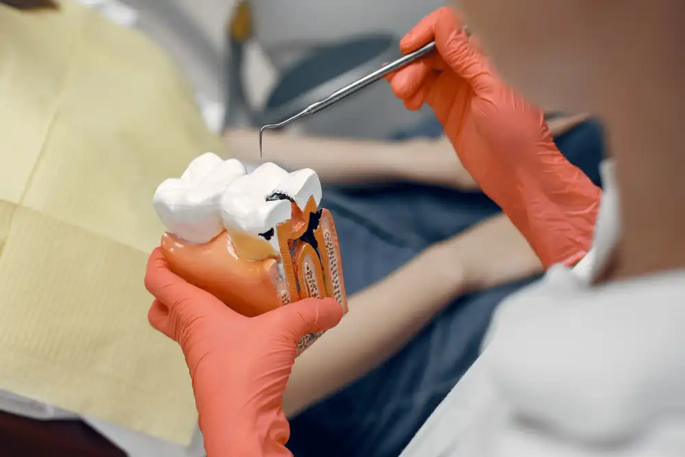 Root-Canal-Treatment