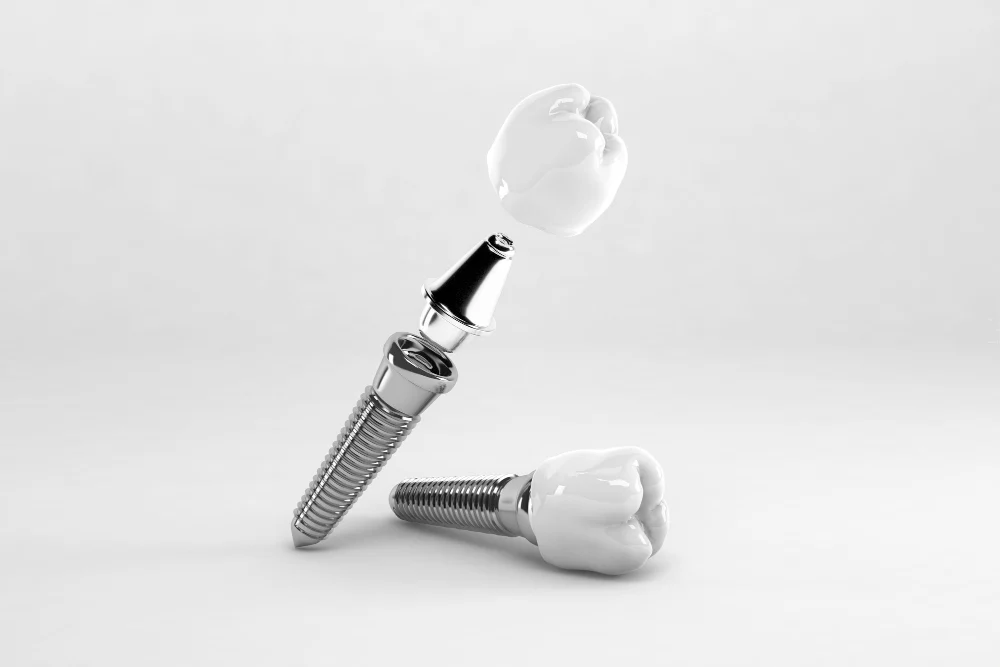implant-2