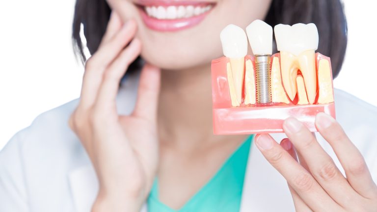Uplifting Blog Banner with Dental Implants (1)