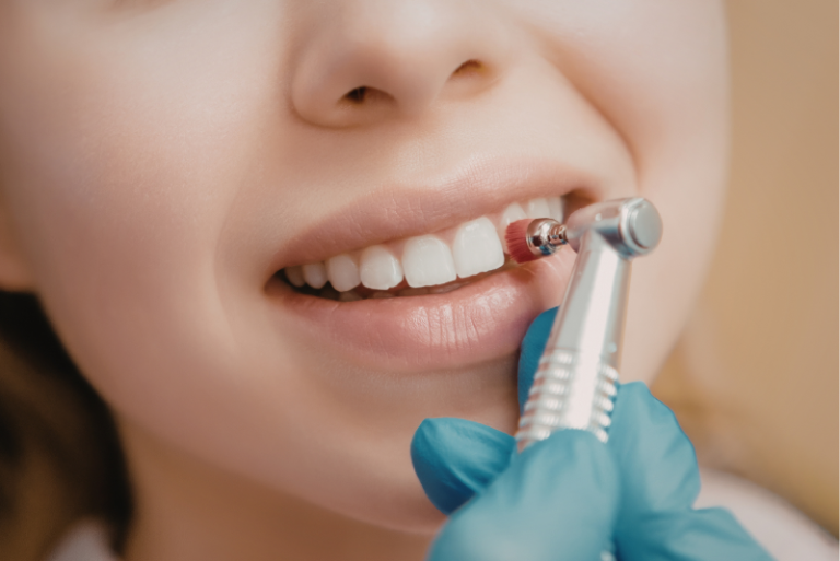 spring-clean-your-smile-why-march-is-the-perfect-time-for-a-dental-cleaning