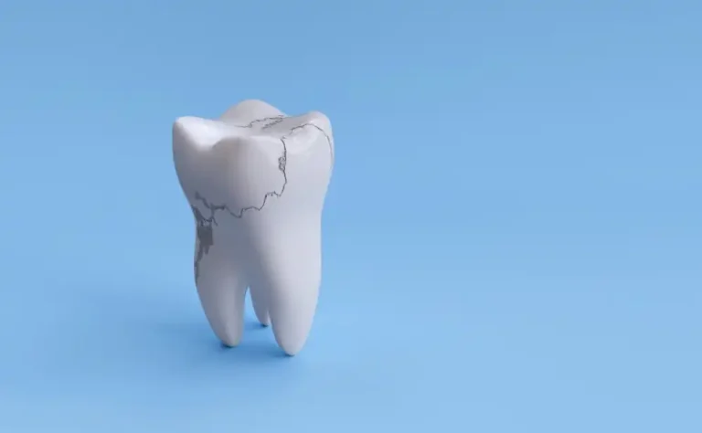 dental-emergencies-in-summer-what-to-do-if-you-chip-or-break-a-tooth