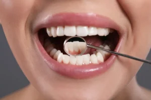 Oral_Cancer