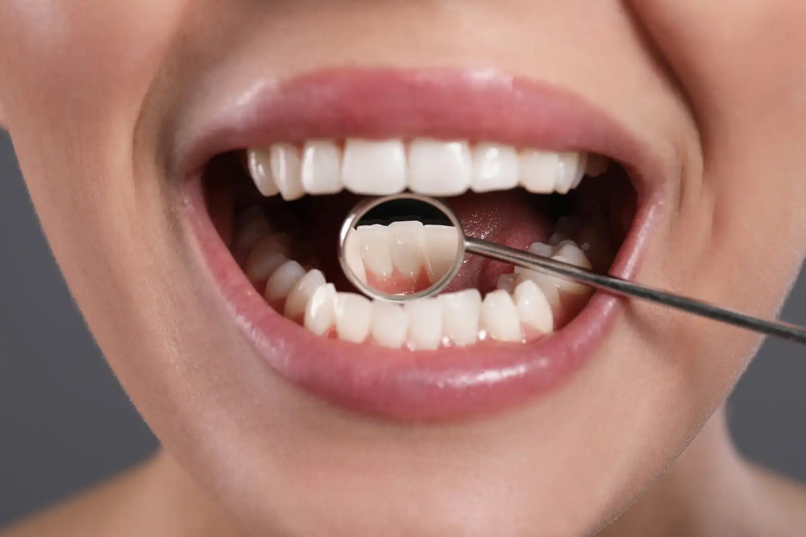 Oral_Cancer