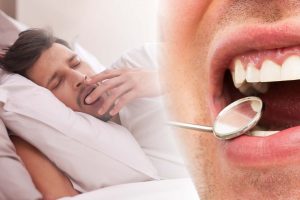 Oral health and sleep apnea